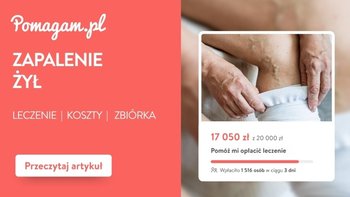 Zapalenie żył – ile kosztuje diagnoza, leczenie i opieka? – kosztorys 2026