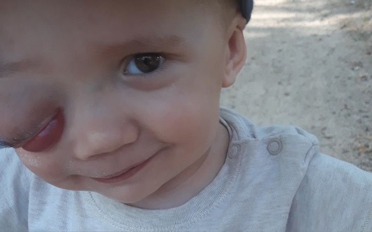 Wpis Ta historia porusza tysiące osób! Ponad 500 000 zł zebrali rodzice na leczenie Szymonka!! - miniaturka zdjęcia