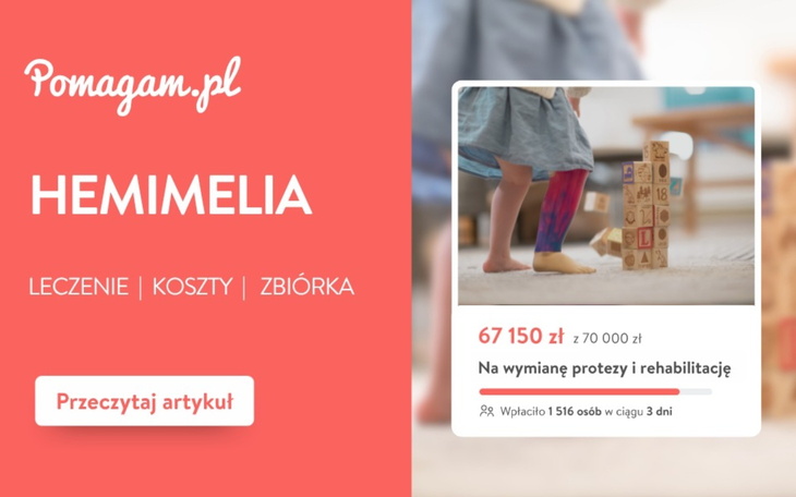 Hemimelia – realny kosztorys leczenia: diagnoza, operacja, proteza