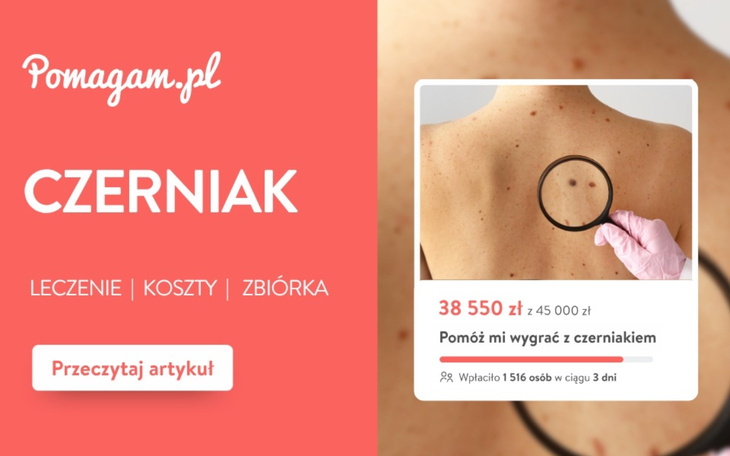 Czerniak – ile kosztuje leczenie?