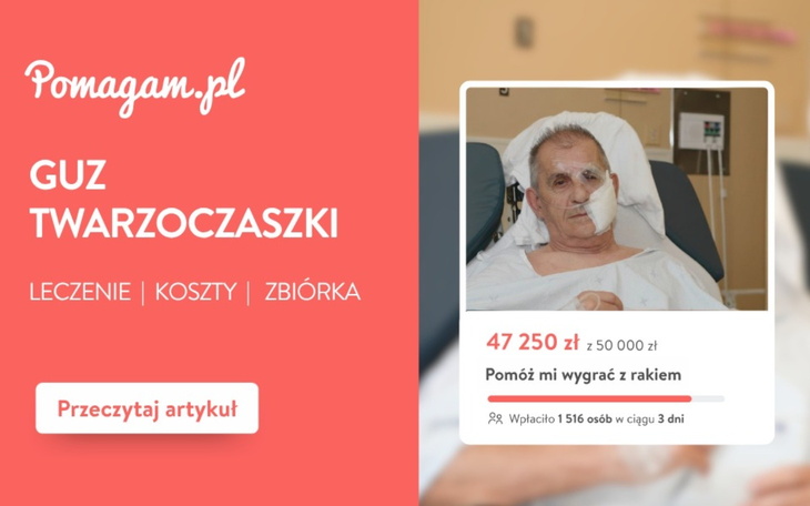 Guz twarzoczaszki – realny kosztorys leczenia od diagnozy do rehabilitacji