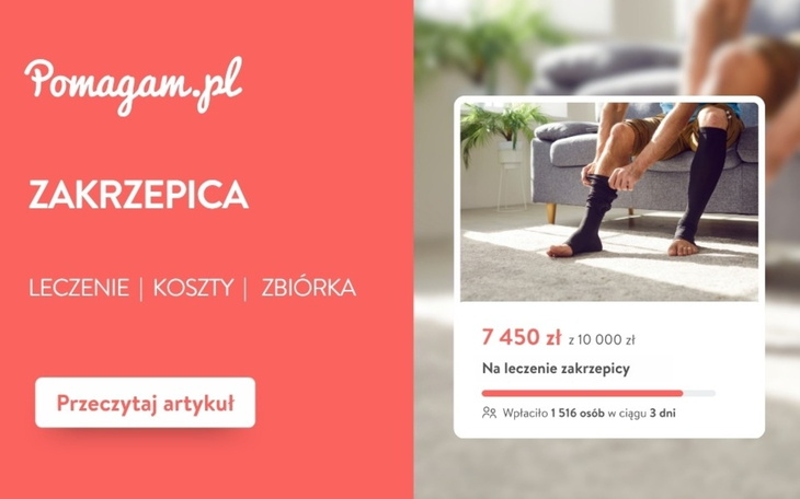 Zakrzepica żył głębokich – ile kosztuje diagnoza i leczenie? – kosztorys 2026