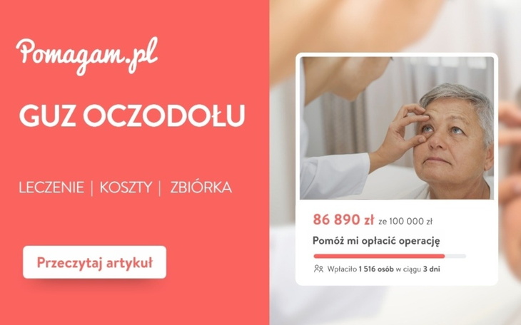 Guz oczodołu: ile kosztuje diagnoza, operacja i rehabilitacja?