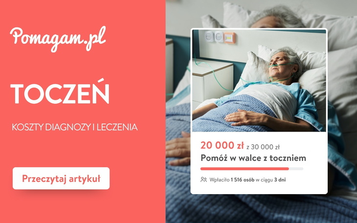 Wpis Leczenie tocznia i terapie powiązane z chorobą [kosztorys] - miniaturka zdjęcia