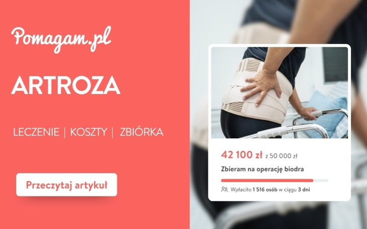 Artroza – realny kosztorys leczenia od diagnozy po endoprotezę
