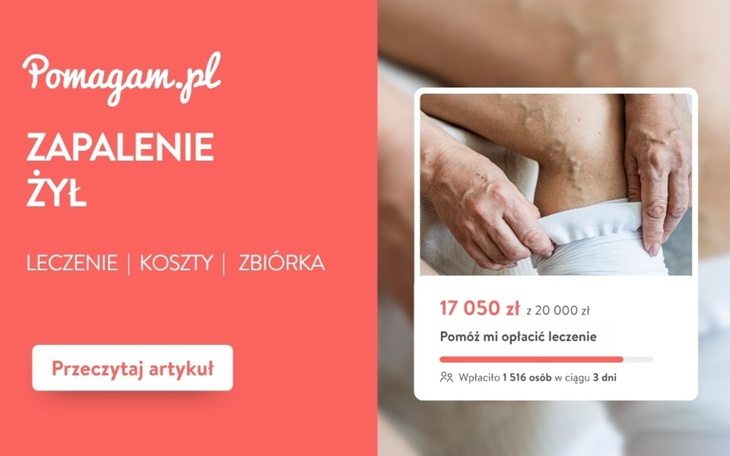Zapalenie żył – ile kosztuje diagnoza, leczenie i opieka? – kosztorys 2026