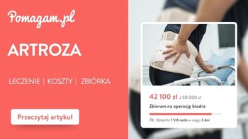 Artroza – realny kosztorys leczenia od diagnozy po endoprotezę