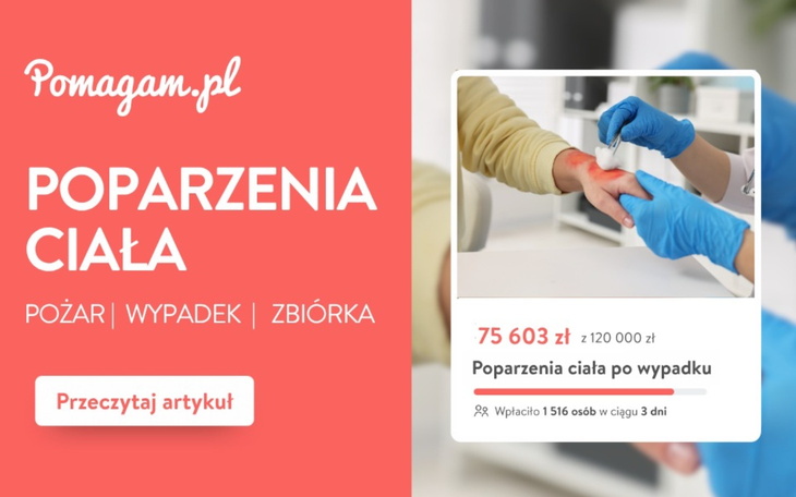 Poparzenia ciała po wypadku, bądź pożarze? Sprawdź jak założyć darmową zbiórkę na leczenie