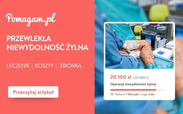 Ile kosztuje leczenie niewydolności żylnej? – kosztorys 2026