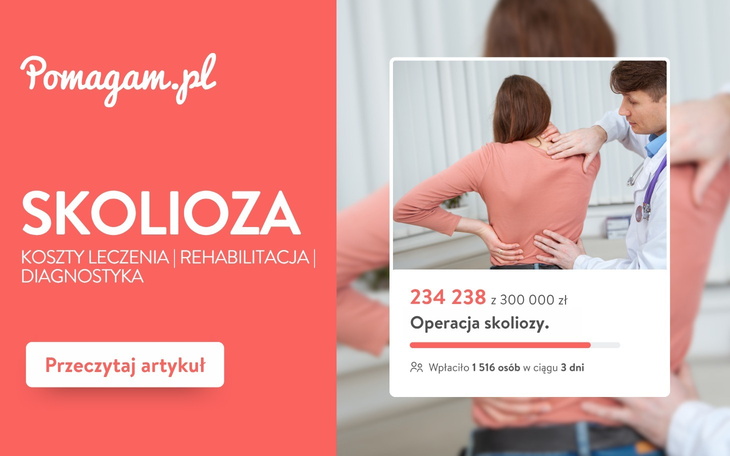 Skolioza: diagnostyka, rehabilitacja i metody leczenia [kosztorys]