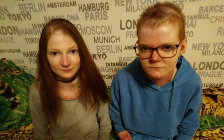 Wpis Mama zebrała ponad 200 000 zł na leczenie swoich córek! - miniaturka zdjęcia