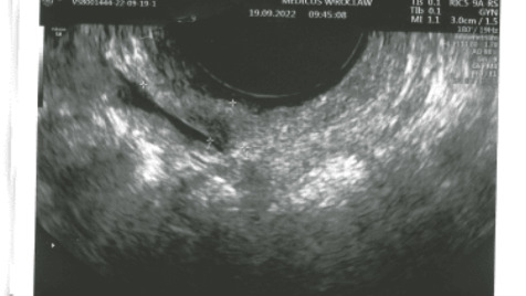 Zdjęcie aktualizacji 111 794