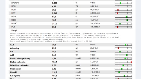 Zdjęcie aktualizacji 144 372