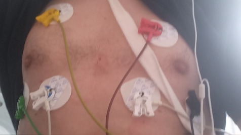 Zdjęcie aktualizacji 155 378