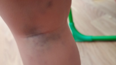 Zdjęcie aktualizacji 166 262