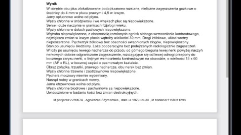 Zdjęcie aktualizacji 170 349