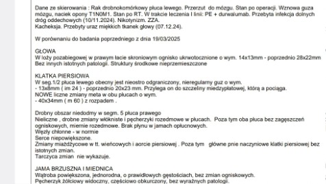 Zdjęcie aktualizacji 170 474