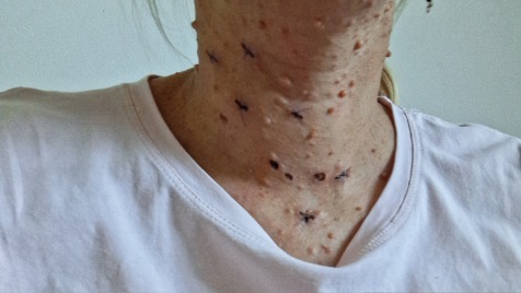 Zdjęcie aktualizacji 172 893