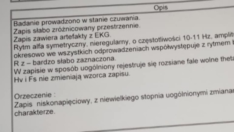 Zdjęcie aktualizacji 173 475
