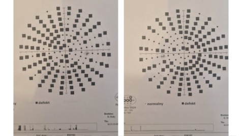 Zdjęcie aktualizacji 173 704