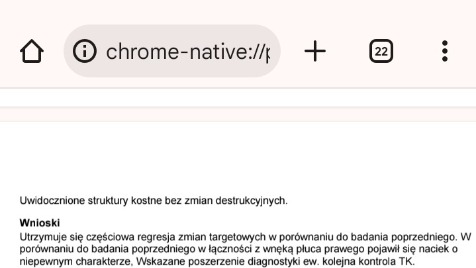 Zdjęcie aktualizacji 174 206