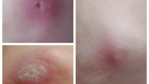 Zdjęcie aktualizacji 175 599