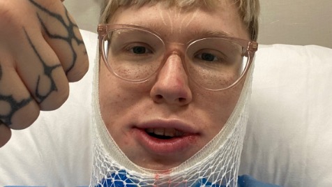 Zdjęcie aktualizacji 176 281