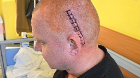 Zdjęcie aktualizacji 176 301