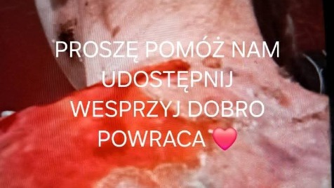 Zdjęcie aktualizacji 177 626