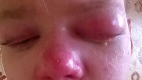 Zdjęcie aktualizacji 178 172