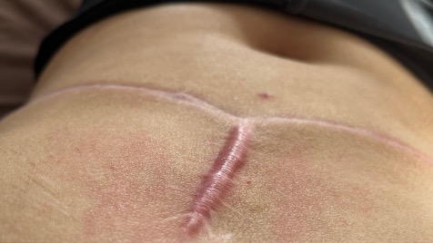 Zdjęcie aktualizacji 178 538