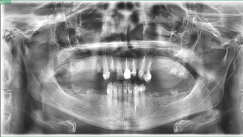 Zdjęcie aktualizacji 179 205