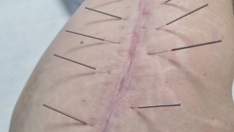 Zdjęcie aktualizacji 179 288