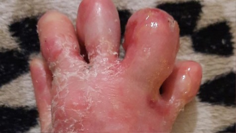 Zdjęcie aktualizacji 179 692