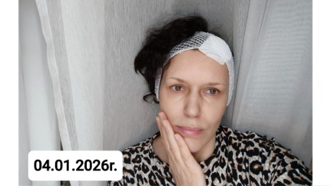 Zdjęcie aktualizacji 180 358