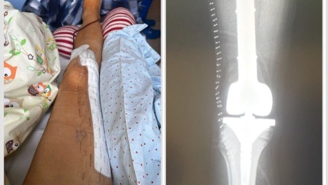 Zdjęcie aktualizacji 180 535