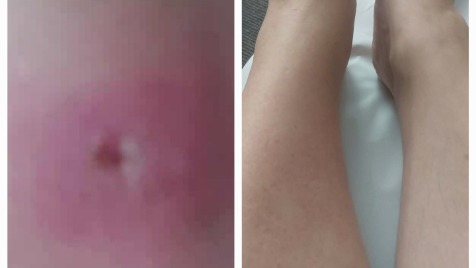 Zdjęcie aktualizacji 181 724