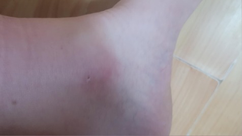 Zdjęcie aktualizacji 182 938