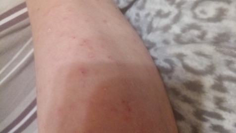 Zdjęcie aktualizacji 183 338