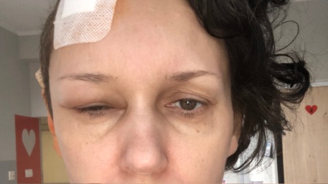 Zdjęcie aktualizacji 183 522