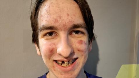 Zdjęcie aktualizacji 183 983