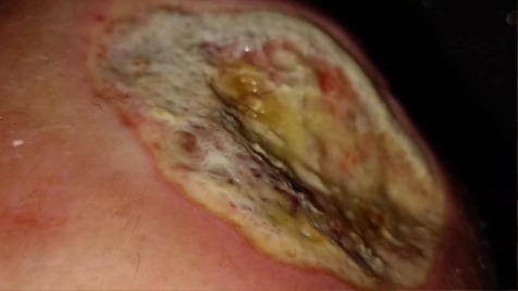 Zdjęcie aktualizacji 184 491