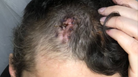 Zdjęcie aktualizacji 184 720