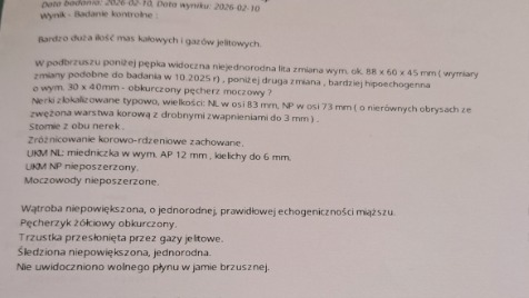 Zdjęcie aktualizacji 185 562