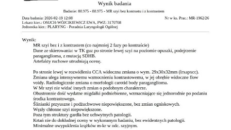 Zdjęcie aktualizacji 185 695