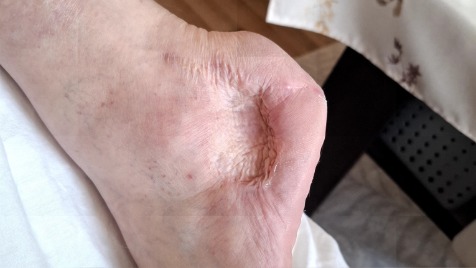 Zdjęcie aktualizacji 186 580