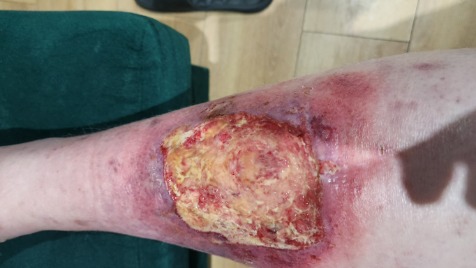 Zdjęcie aktualizacji 186 889