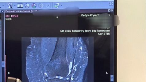 Zdjęcie aktualizacji 186 968