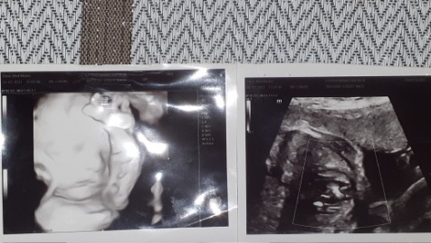 Zdjęcie aktualizacji 73 199