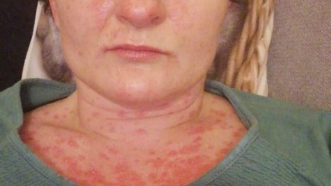 Zdjęcie aktualizacji 85 831